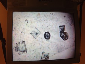 Feces crystals